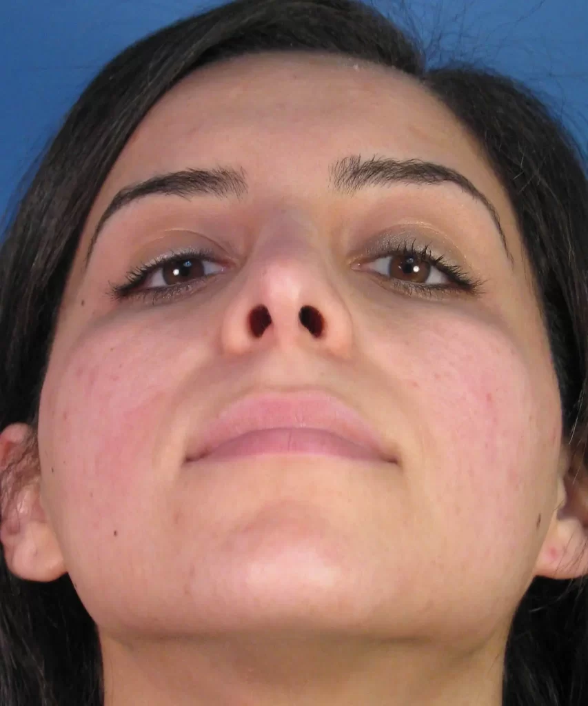 A person looking up at the camera against a blue background.