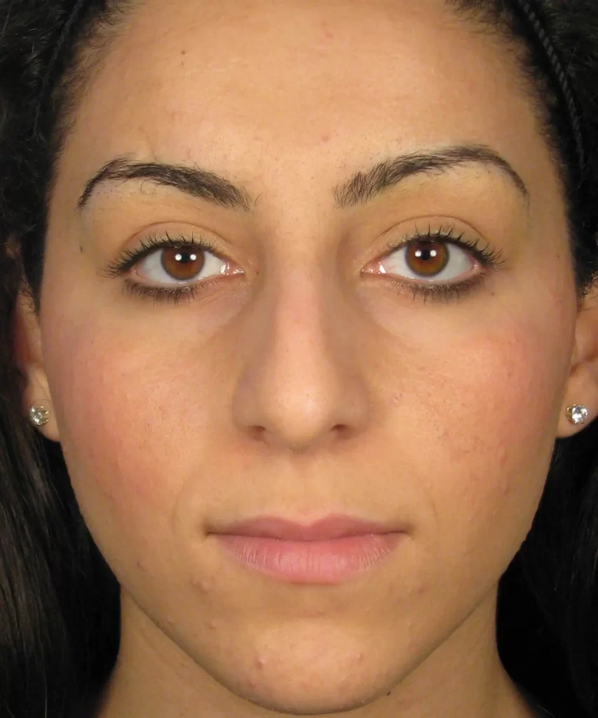A person with long dark hair and brown eyes looks directly at the camera, wearing small stud earrings.