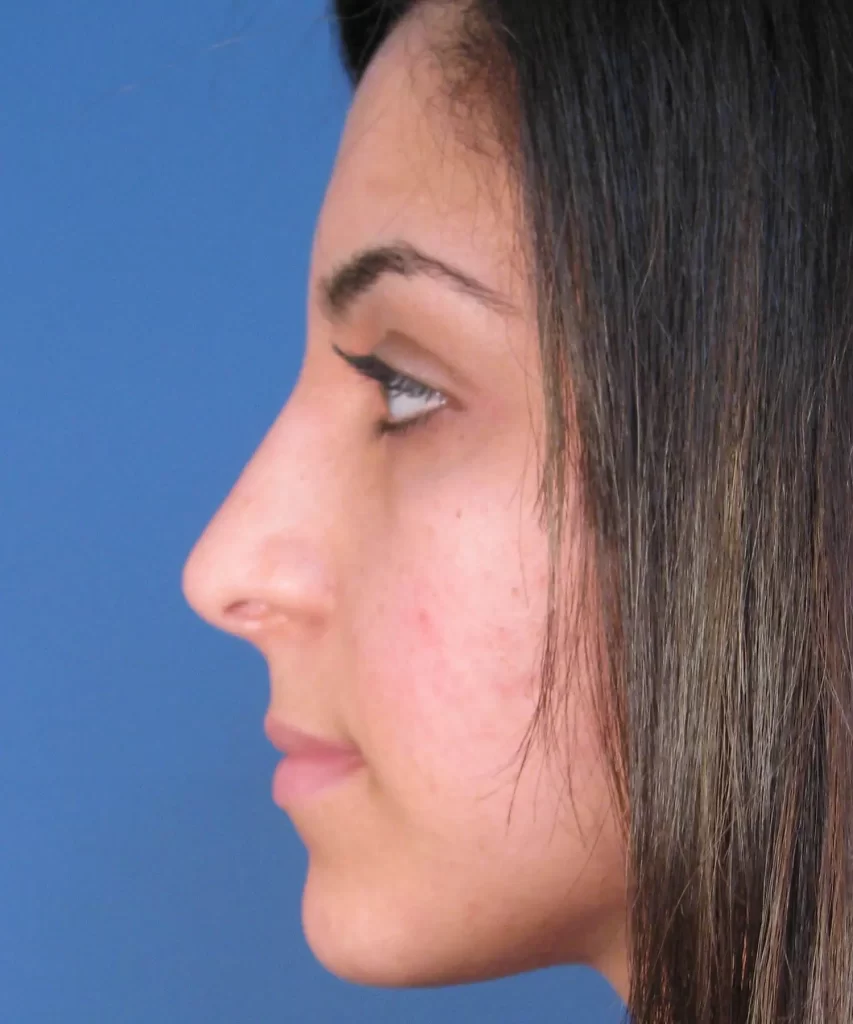 Profile view of a person with long, dark hair against a blue background.