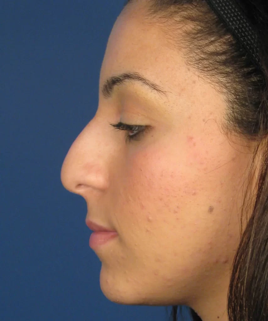 Profile view of a person with long hair against a blue background, highlighting the facial features.