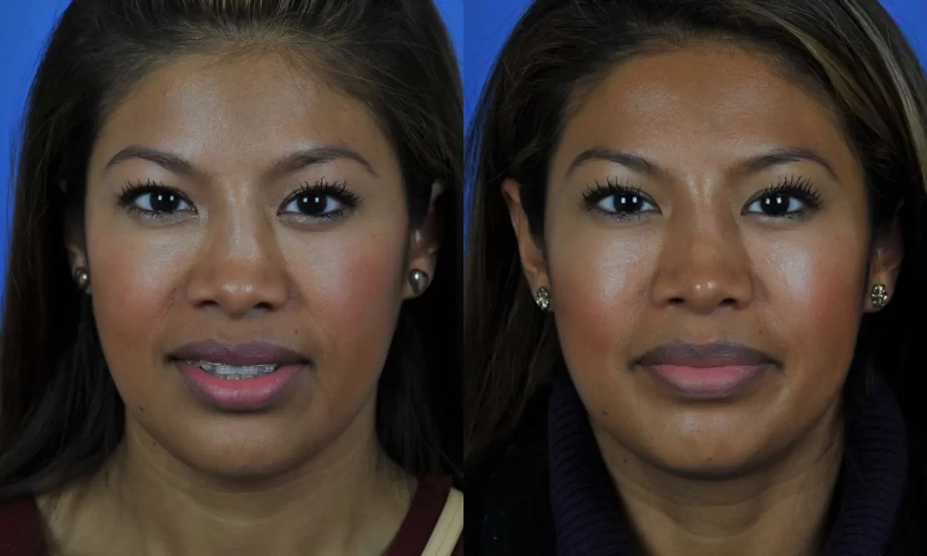 Two side-by-side portraits of a woman with straight hair, one showing her with makeup and the other without. Both images have a blue background.