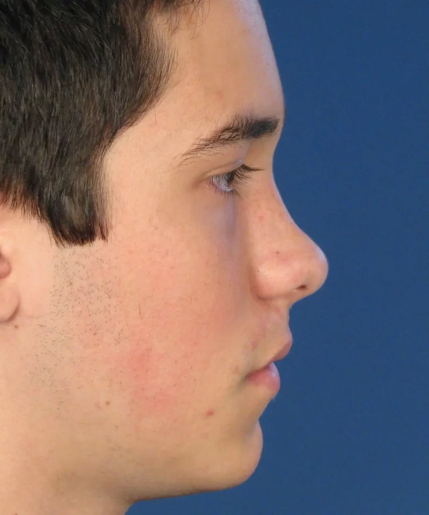 Profile view of a person with short dark hair against a blue background.
