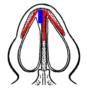 Diagram of a nasal cavity with red and blue highlighted sections representing airflow inside the nose.