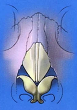 Abstract symmetrical design with a floral shape at the bottom center, set against a blue background.