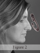 Profile of a woman with an illustration of a large hook in front of her nose.