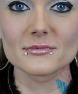 Before Frontal