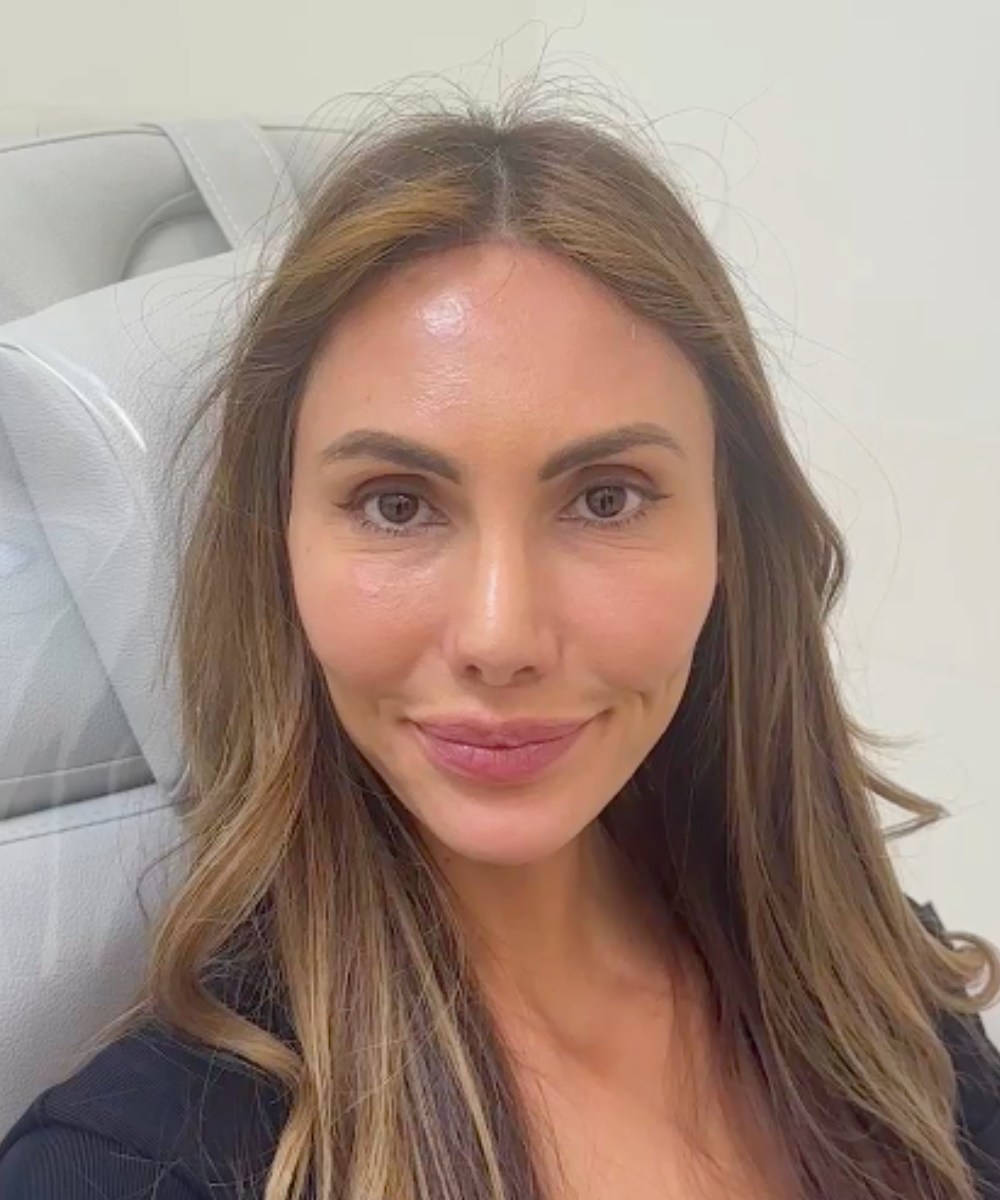 After Frontal