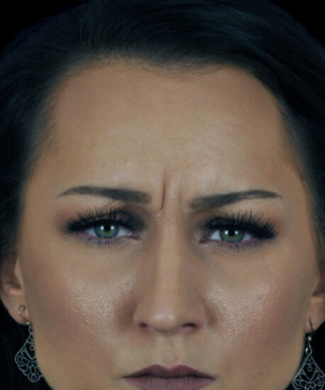 Before frontal frown