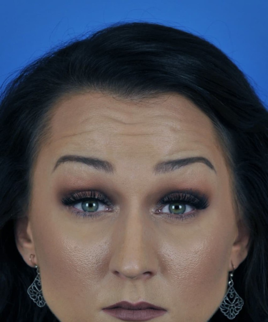 Before frontal raise