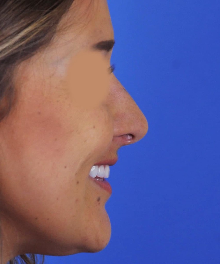 After smiling