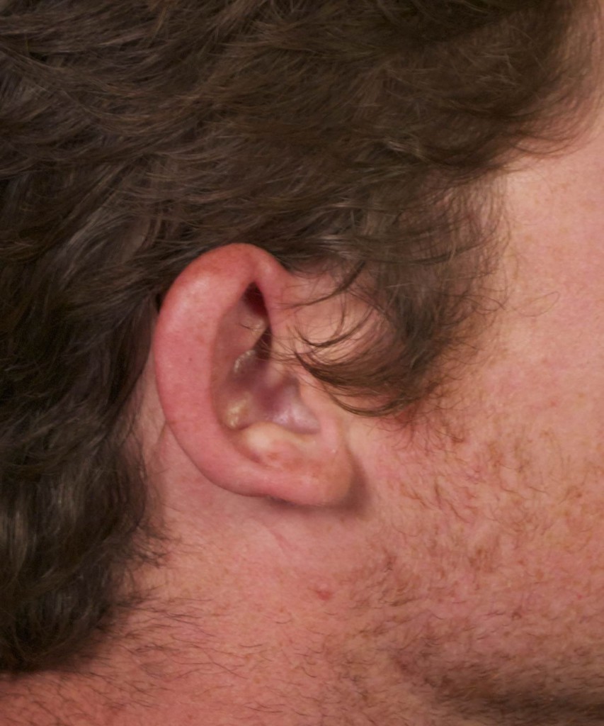 Before lateral right