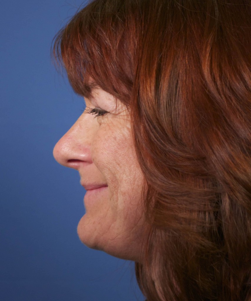 After side smiling