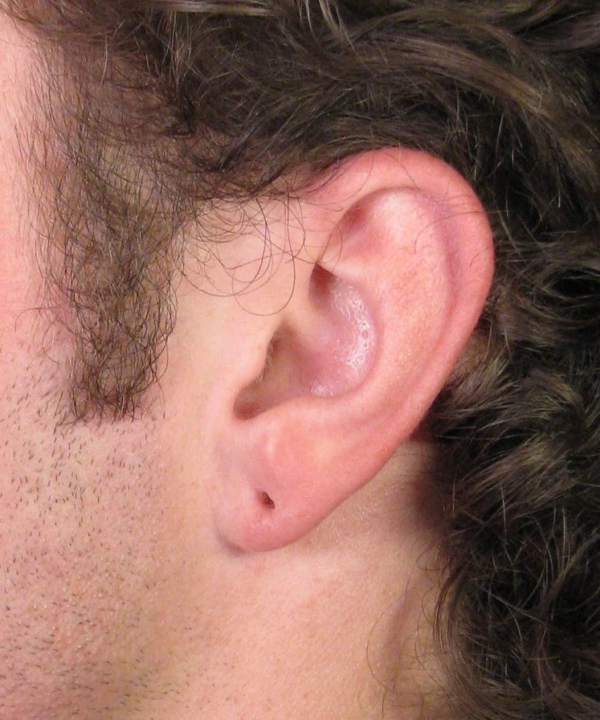 Before side